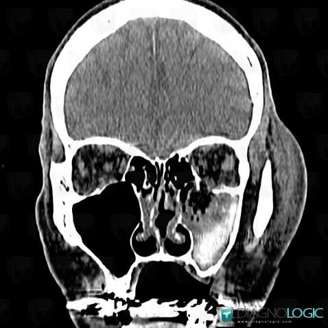 Cas Radiologie Post Traumatique Scanner Diagnologic