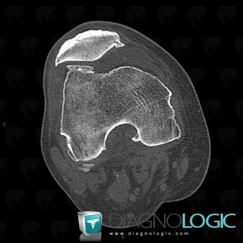 Cas radiologie : Géode (Scanner) - Diagnologic