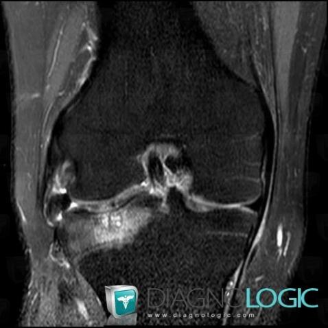 Cas radiologie : Géode (Scanner ,IRM ,Radio) - Diagnologic