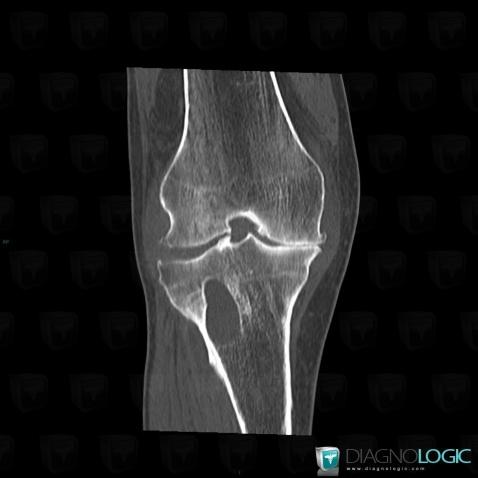 Cas radiologie : Géode (Scanner) - Diagnologic