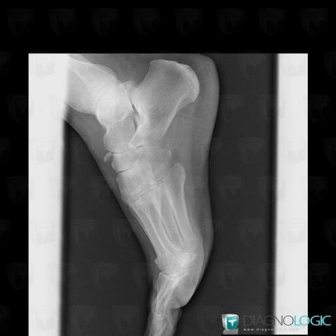 Fracture, Navicular, X rays