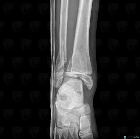 Radiology Case Fracture X Rays Diagnologic