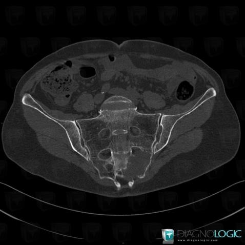 Radiology case : Metastasis (CT ,MRI) - Diagnologic