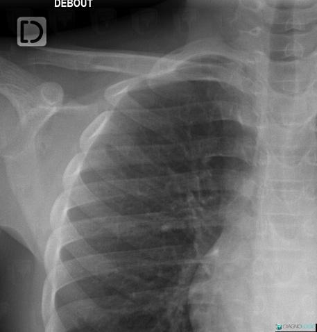 Radiology case : Normal variant (X rays ,CT) - Diagnologic